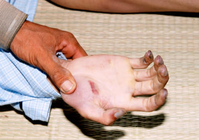 Can phạm treo cổ tự vẫn, gia đình nghi công an dùng nhục hình